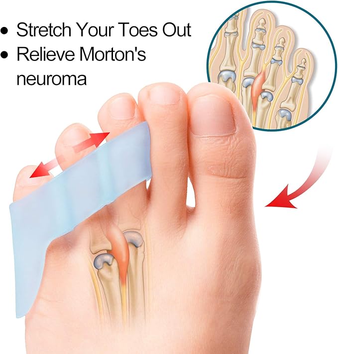 Povihome 10 Pack Pinky Toe Separator and Protectors for Overlapping Toe, Curled Pinky Toes - Spacers for Morton's Neuroma Pain Relief - Image 2