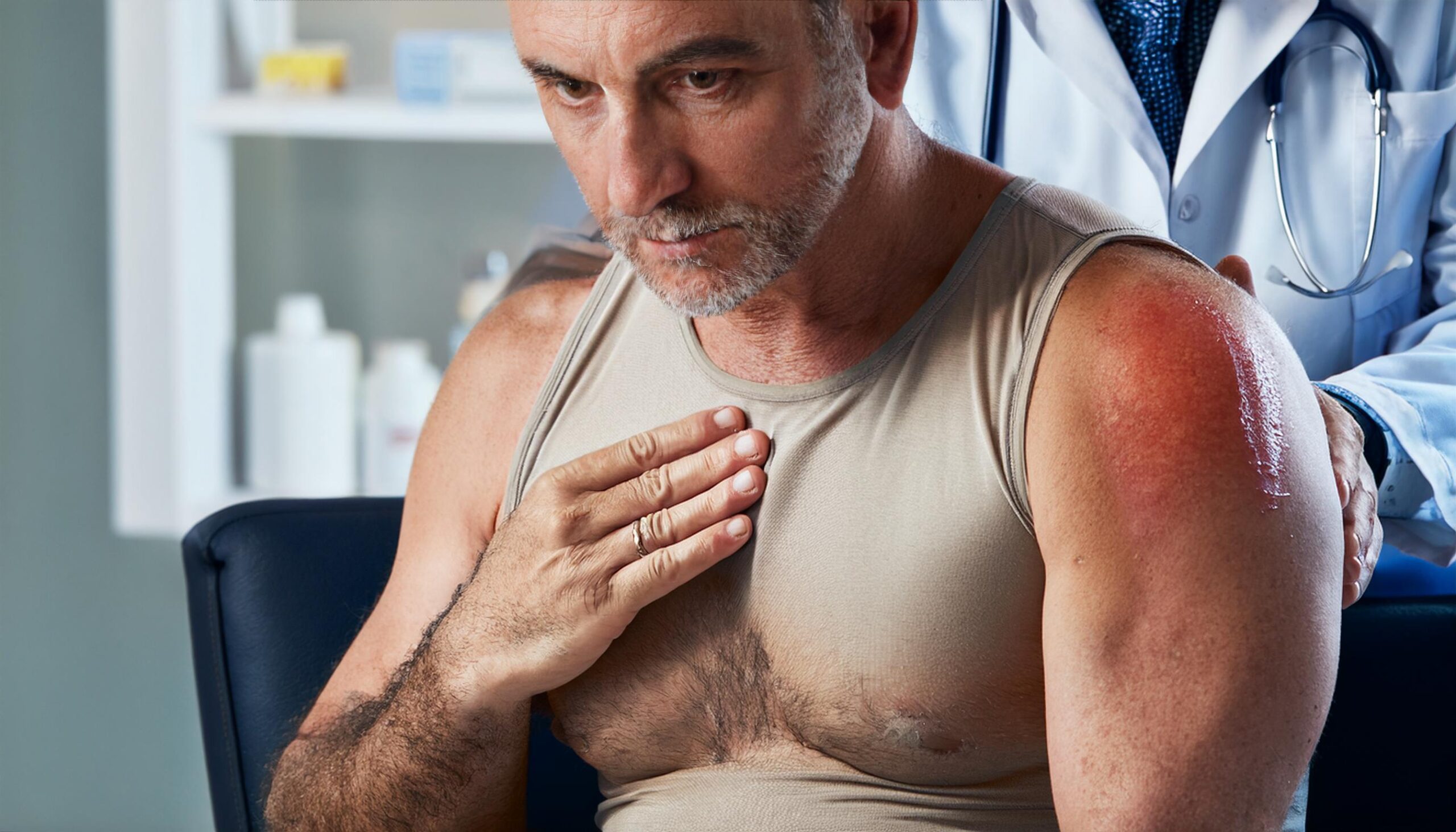 Managing Shingles and Dealing with the Lingering Pain