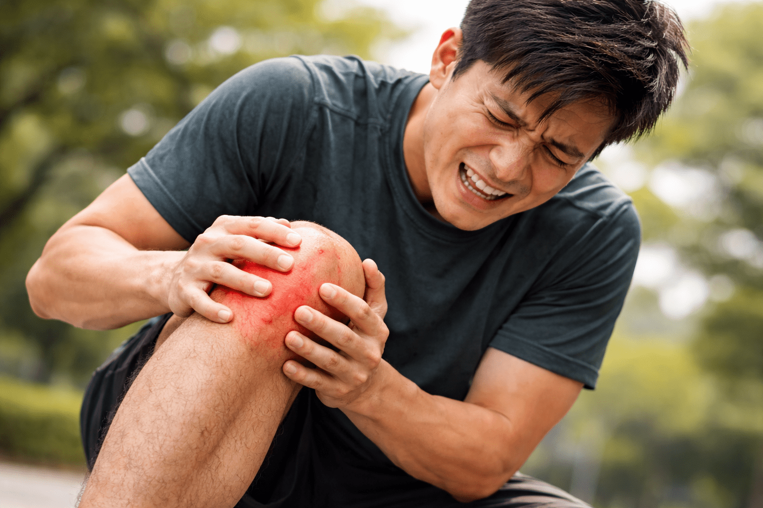 MCL Sprain Knee Illustration