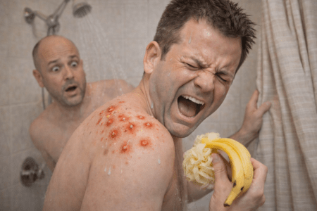 Folliculitis: When Your Hair Follicles Unionize and Choose Violence